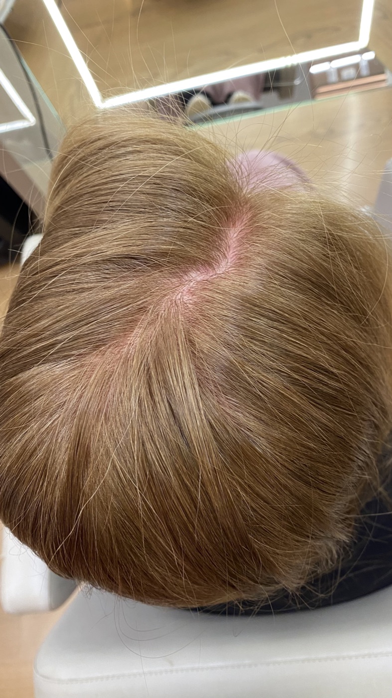Primeiro registro do cabelo depois da coloração