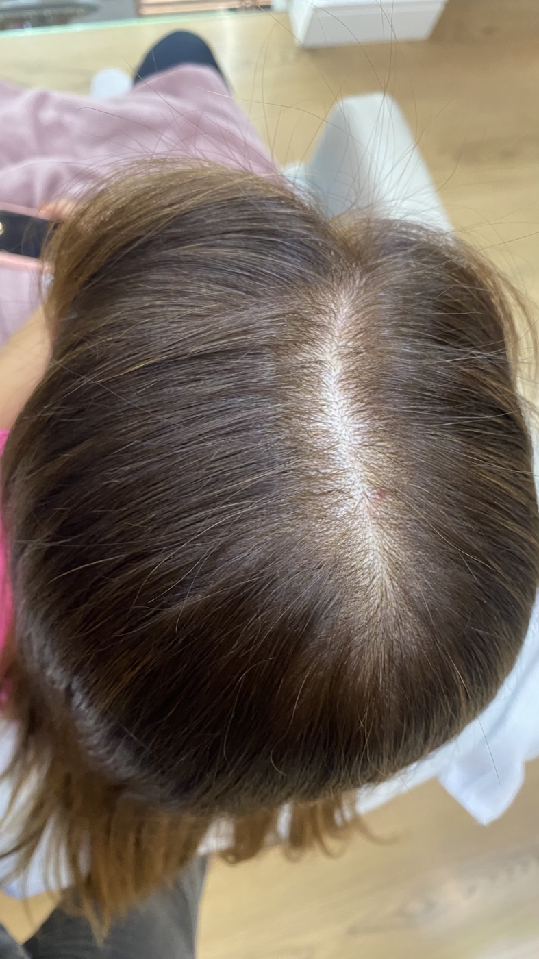 Cabelo depois da aplicação da cor e do tratamento