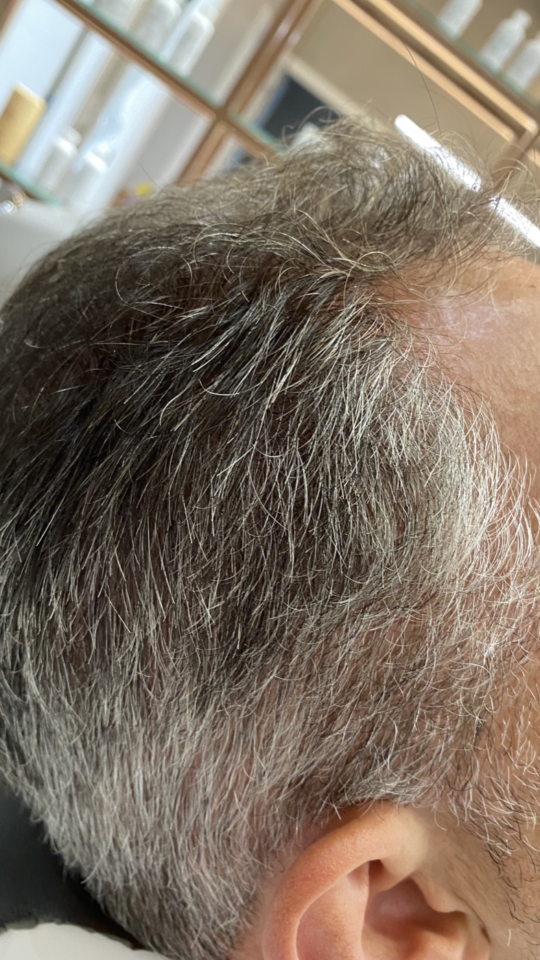 Cabelo antes da camuflagem de brancos
