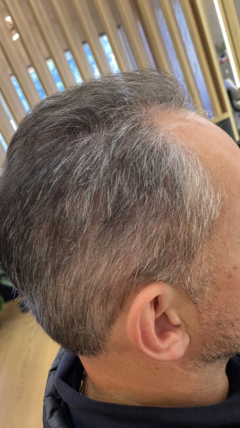 Cabelo depois da camuflagem de brancos